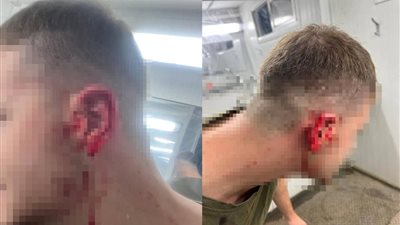 فئران تهاجم خيامًا للجيش الإسرائيلي وتأكل أذن جندي وأنف آخر.. ما القصة؟