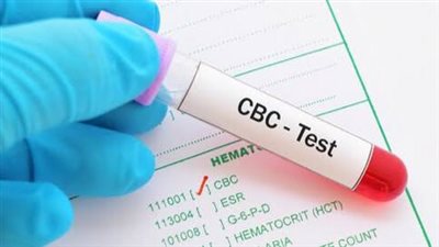 أهمية فحوصات الدم للرجال بعد سن الثلاثين