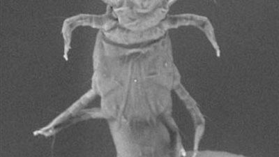  حشرات صغيرة تسبب الطفح الجلدي بالولايات المتحدة.. هل تشهد أمريكا وباء؟ 