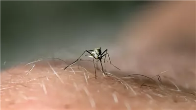 مدن بالولايات المتحدة تفرض إغلاقًا لمنع انتشار مرض قاتل.. ما القصة