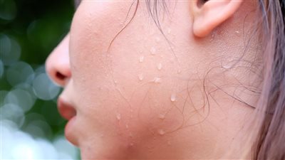 أسباب التعرق الزائد في الوجه.. دكتور أمراض قلب يحذر من علامات مرافقة للعرق