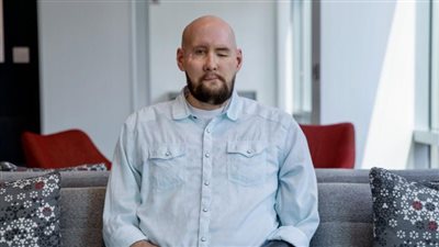 نجاح أول عملية زرع كاملة للعين والوجه في العالم.. ما القصة؟