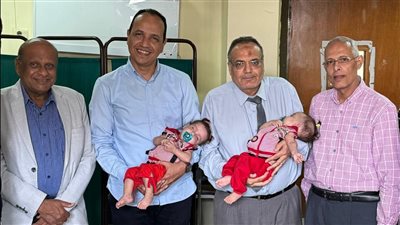 بعد عملية استغرقت 8 ساعات.. نجاح فصل توأم ملتصق بمستشفى الأطفال بجامعة أسيوط