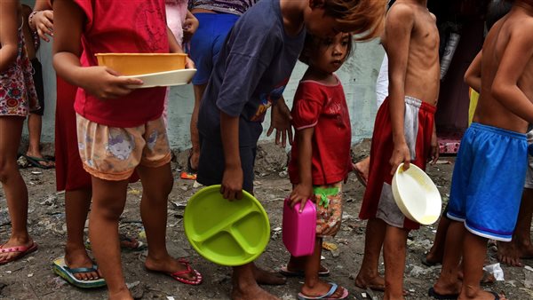 سوء التغذية - تعبيرية