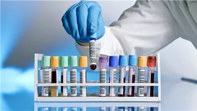 سيتي للتحاليل الطبية تقرر الاستحواذ على معامل حساب مقابل 298 مليون جنيه 