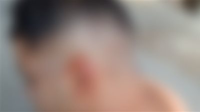 التقرير الطبي لطالب الأميرية بعد الاعتداء عليه: يعاني من جرح قطعي باليد اليمنى