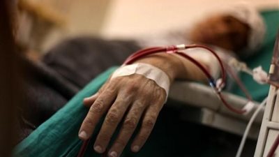المواطن لا يتحمل شيئا.. الصحة تدرس زيادة سعر جلسات الغسيل الكلوي في الموازنة لتصل لـ1000 جنيه| خاص