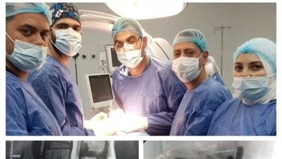 فريق جراحي بمستشفى كفر شكر التخصصي ينقذ حياة سيدة من الشلل بعد تركيب قفص كربوني