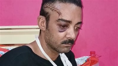 طالبت بحقي قطعوا صوابعي.. صاحب محل قطع غيار في السويس يستغيث: مستقبلي راح علشان 500 جنيه| بث مباشر