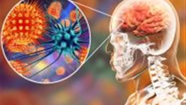 السل الدماغي 