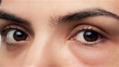  عادات يومية اتبعها للوقاية من إجهاد العين في الشتاء.. بينها الرمش وتحسين الإضاءة