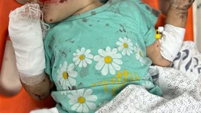 أوجاع تحت الركام.. نقابة الأطباء تدين قصف الاحتلال مستشفى المعمداني في غزة: أوقفوا هذا الجنون 