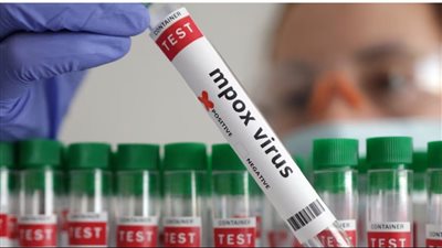 حاملها قادم من الخارج.. السنغال تسجل أول إصابة بفيروس جدري القرود