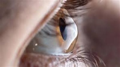 تعرف على أسباب فقدان البصر الناتج عن داء السكري من النوع الثاني