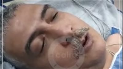 والد ضحية المطرية: سائق قتل ابني وطعني بسكينة في صدري بسبب الخلاف على ركنة سيارة |بث مباشر 