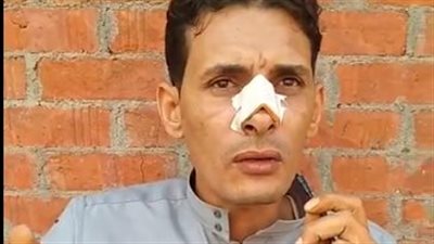 موظف حاول عامل التخلص منه بحبة الغلة بالمنوفية: كان فاكر أني على علاقة بزوجته| بث مباشر 