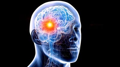 أبرزها القهوة.. تعرف على مشروبات تُعزز صحة الذاكرة 