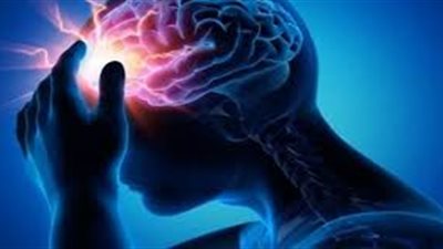 أكسفورد تكشف طريقة لوقف تطور مرض هنتنغتون غير القابل للشفاء| دراسة