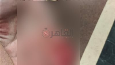 جهات التحقيق تعاين مستشفى الشيخ زايد لكشف ملابسات واقعة اتهام أسرة متوفاة بالتعدي على أطباء