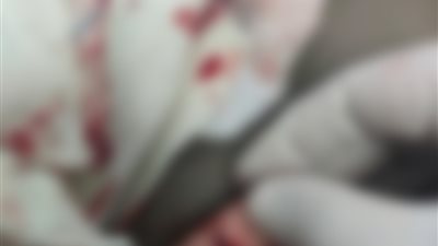 استدعاء 7 أطباء من الطاقم الطبي بمستشفى الشيخ زايد بالقاهرة لسماع أقوالهم في واقعة التعدي