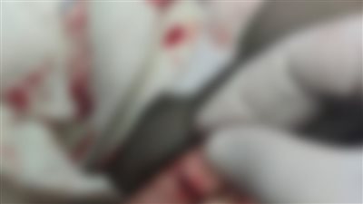 لتعديهم على الطاقم الطبي.. حبس نجل المتوفاة في واقعة مستشفى الشيخ زايد وزوج شقيقته