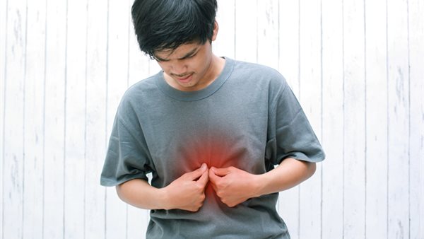 حرقة المعدة 