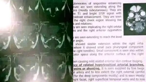 أم تستغيث لعلاج ابنتها