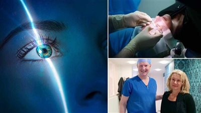 تحسن الرؤية الليلية.. أطباء ينجحون في إجراء أول عملية جراحية بالليزر للعيون