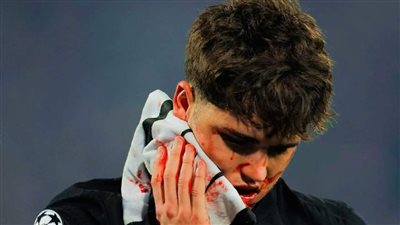 آخر تطورات إصابة كوبارسي وموقفه من المشاركة أمام سوسيداد بالدوري الإسباني 