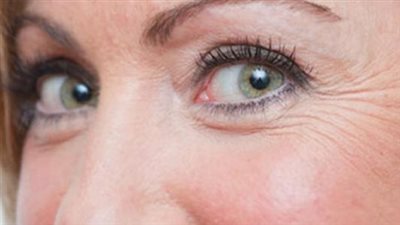 أسباب ظهور التجاعيد حول العين وطرق علاجها 