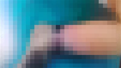 سيدة تستغيث من مستشفى قصر العيني: ابني كان بيعاني من صعوبة تنفس بعدها قالولي هيحتاج لبتر قدمه