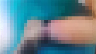 ننشر التقرير الطبي لـ الطفل مالك صاحب واقعة إهمال مستشفى قصر العيني: يعاني من صعوبة التنفس