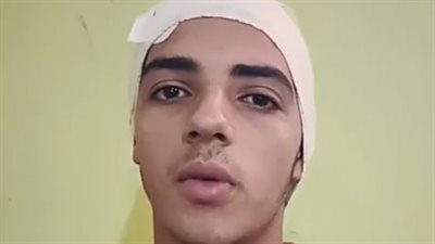 سائق يروي تفاصيل التعدي عليه بالبحيرة: ضربوني وسرقوا التوك توك بتاعي.. ومليش مصدر دخل غيره | بث مباشر