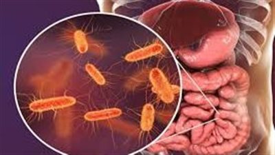 بسبب تناول الجزر.. وفاة شخص وإصابة 39 آخرين بعدوى البكتيريا الإشريكية القولونية في أمريكا 