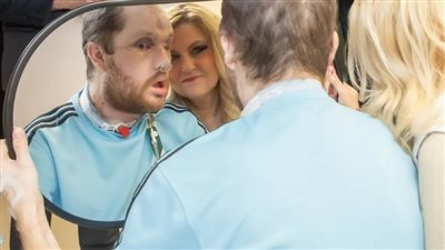 فقد أنفه وشفتيه وأسنانه.. أمريكي يخضع لعملية زرع وجه مبتكرة بعد محاولة إنهاء حياته 