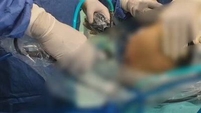 أمريكية تحرر محضرًا ضد عيادة تجميل بأكتوبر بعد تعرضها لحروق خطيرة