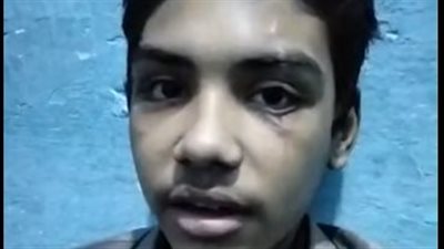 استغاثة شاب تعدى عليه آخر خلال لعب الكرة بالمنوفية: خلى أصحابه كتفوني وضربني بـ كاتر في وشي خدت 35 غرزة |بث مباشر 