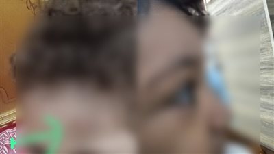 ورم في الرأس وتجمع دموي بالعين.. شكاوى لأولياء أمور ضد حضانة في مصر الجديدة