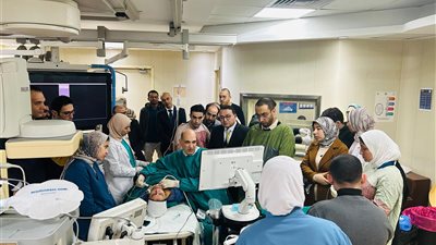 عميد معهد الكبد القومي بجامعة المنوفية: التقنية الجديدة للكيّ الحراري توفر بديلًا فعالًا للجراحة التقليدية