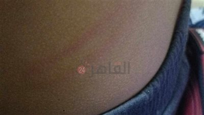  ضربه بالخرطوم| معلم تربية رياضية يعتدي على طالب في مدرسة بطنطا.. والتعليم تحقق