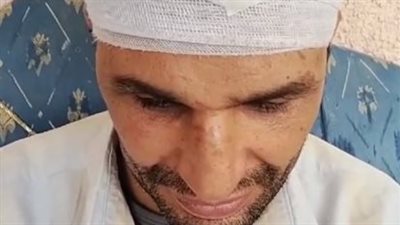 كفيف اقتحم لص منزله وتعدى عليه بالمنوفية: ضربني أنا ومراتي وعورني 50 غرزة | بث مباشر