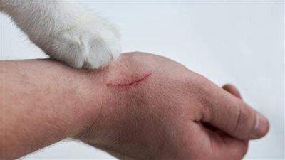حتى بدون دم.. خطورة خربشة القطة السطحية وأهم ما يجب فعله