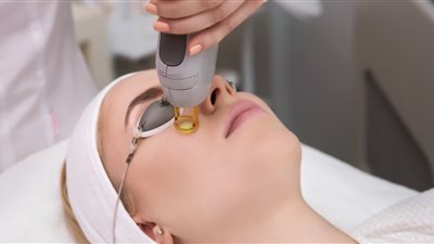 خطورة إزالة الشعر بالليزر للنساء.. احذري يتسبب في زيادة الشعر وتصبغات جلدية
