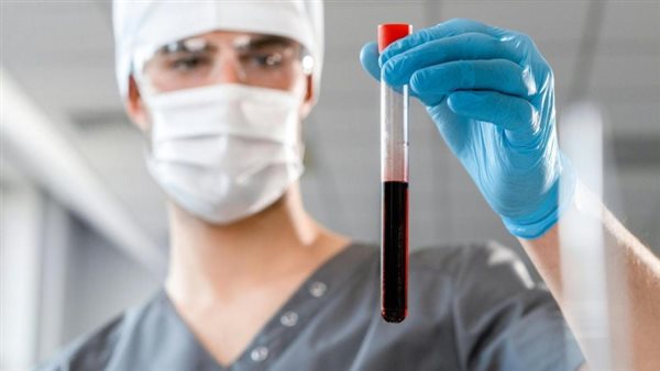 صورة تعبيرية 