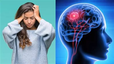 علامات مبكرة لأورام المخ لا يجب تجاهلها