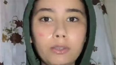 طالبة امتياز تمريض تزعم اعتداء أهالي مريضة عليها بمستشفى المطرية: شوهوا وشي أنا وزميلتي وبيحاولوا معايا عشان أتنازل 