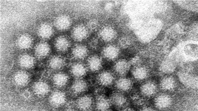 بعد انتشاره في بريطانيا.. تحذيرات من خطورة فيروس نيوروفيروس 