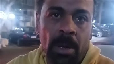 جيران المطرب الشعبي أحمد عدوية: كان بيعتبرنا أهله وكل الناس زعلانة عليه| بث مباشر 