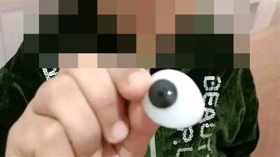 فتح بها كافيه.. أسرة طفلة تتهم شخصا بجمع تبرعات بزعم علاج ابنتها من السرطان