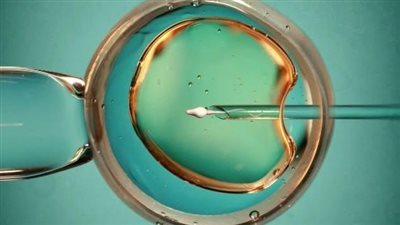 دراسة: الذكاء الاصطناعي قد يجعل التلقيح الصناعي أكثر نجاحًا